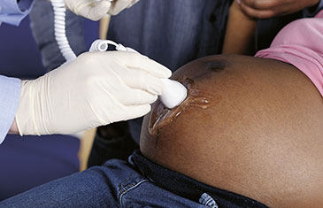 Foto des schwangeren Bauches einer dunkelhäutigen Frau bei der Untersuchung