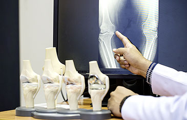 Foto eines Röntgenbildes, auf das ein Arzt zeigt. Davor stehen Modelle von Gelenken.